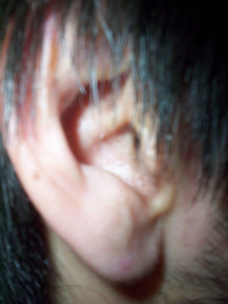 100_5841.jpg